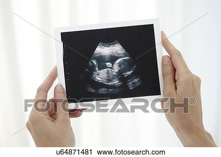 Baby scan View Large Photo Image Stock Image - Baby scan. Fotosearch