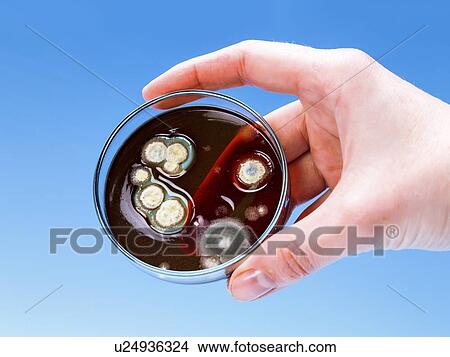 Picture - Bacterial colonies on Petri dish. Fotosearch