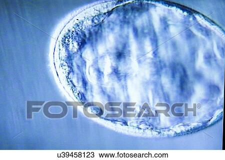Blastocyst embryo, light micrograph View Large Photo Image Stock Image - Blastocyst embryo, light micrograph. Fotosearch