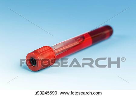 Stock Image - Blood sample. Fotosearch