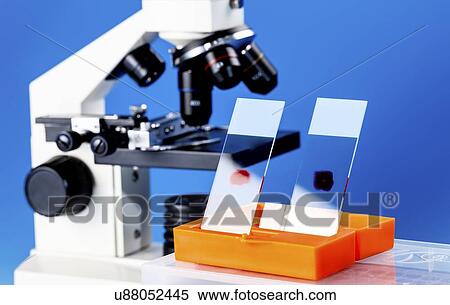 Blood smears View Large Photo Image Stock Photography - Blood smears. Fotosearch