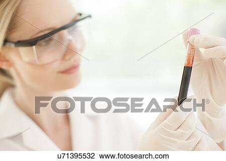 Blood test View Large Photo Image Stock Image - Blood test. Fotosearch