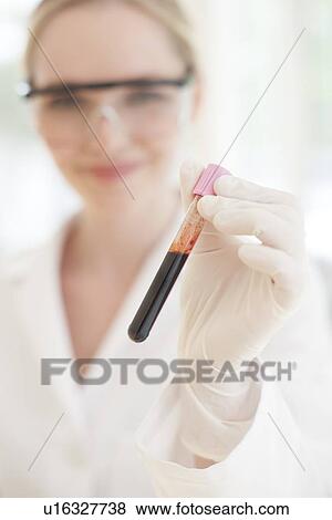 Blood test View Large Photo Image Stock Photo - Blood test. Fotosearch