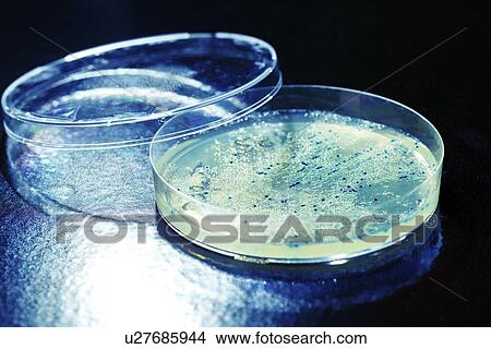 Picture - Colonies on Petri dish. Fotosearch