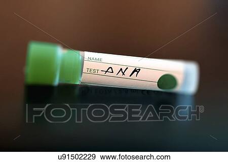 Stock Photo - DNA sample tube. Fotosearch
