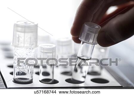 Picture - Harvested human eggs. Fotosearch