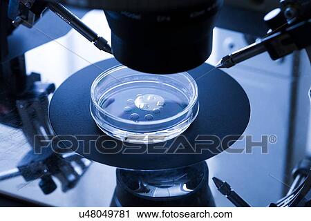 Stock Image - IVF treatment. Fotosearch