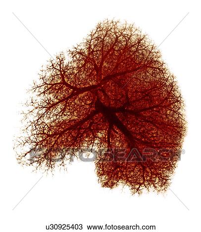 Lung, X-ray View Large Photo Image Stock Image - Lung, X-ray. Fotosearch