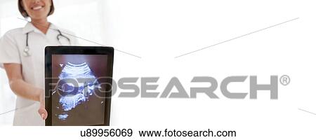 Stock Photo - Nurse with baby scan. Fotosearch