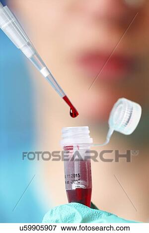 Stock Photo - Pipetting blood sample. Fotosearch