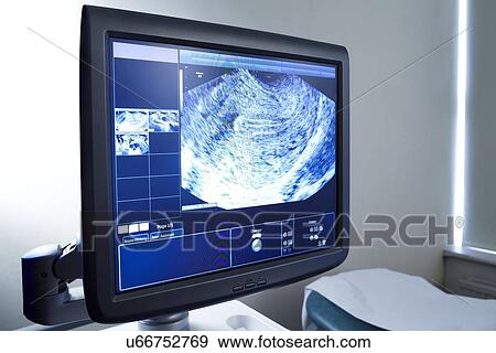 Stock Photo - Ultrasound scan. Fotosearch