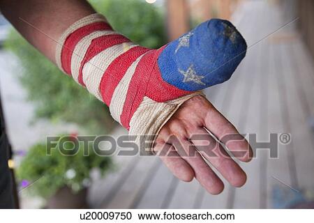 Patriotic cast on man with broken hand View Large Photo Image Stock Image - Patriotic cast on man with broken hand. Fotosearch