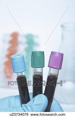 Stock Photo - Color coded blood tubes containing synthetic blood samples. Blue top - buffered sodium citrate. Green top - lithium heparin anticoagulant. Lavender top - K2-EDTA anticoagulant. Fotosearch