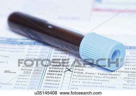 Stock Photo - Color coded tube containing synthetic blood sample on a bloodwork requisition form that lists a test for prostate-specific antigen (PSA). Fotosearch