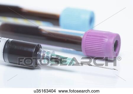 Picture - Disposable plastic medical syringe and color coded tubes containing synthetic blood samples. Blue top - buffered sodium citrate. Lavender top - K2-EDTA anticoagulant. Fotosearch