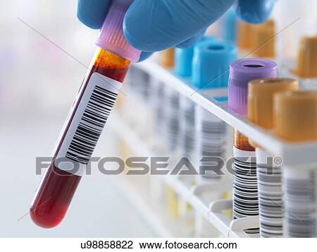 Stock Image - A blood sample being held with a row of human samples for analytical testing including blood, urine, chemistry, proteins, anticoagulants and HIV in lab. Fotosearch