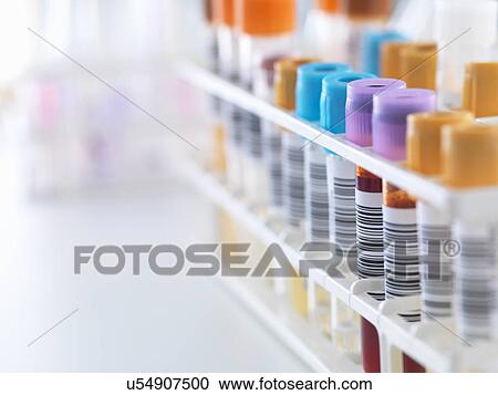 A row of human samples for analytical testing including blood, urine, chemistry, proteins, anticoagulants and HIV in lab View Large Photo Image Stock Image - A row of human samples for analytical testing including blood, urine, chemistry, proteins, anticoagulants and HIV in lab. Fotosearch