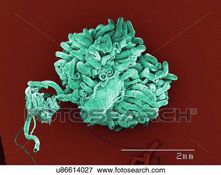 Stock Photo - Coloured SEM of American cockroach gut and malpighian tubuoles. Fotosearch