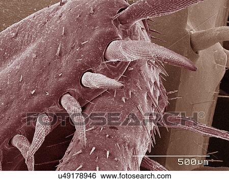 Stock Photograph - Coloured SEM of American cockroach leg. Fotosearch