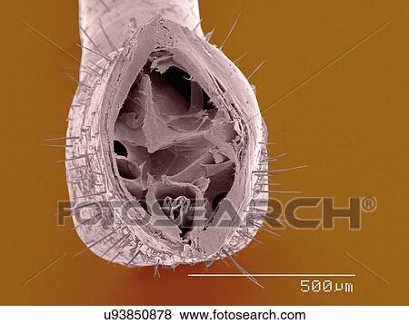 Coloured SEM of assassin bug mouthparts, cross section View Large Photo Image Stock Photo - Coloured SEM of assassin bug mouthparts, cross section. Fotosearch