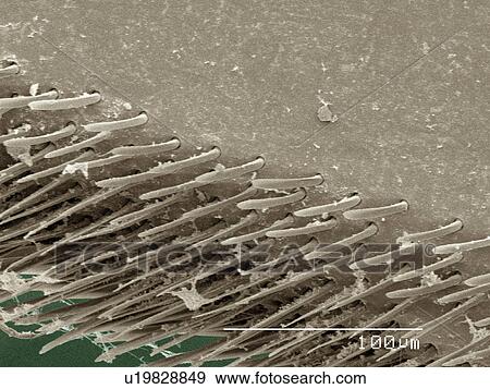Coloured SEM of backswimmer (Notonectidae) leg View Large Photo Image Stock Photo - Coloured SEM of backswimmer (Notonectidae) leg. Fotosearch