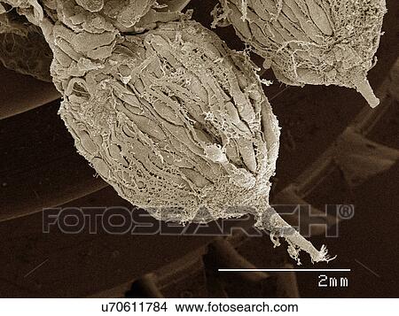 Picture - Coloured SEM of cicada ovaries. Fotosearch