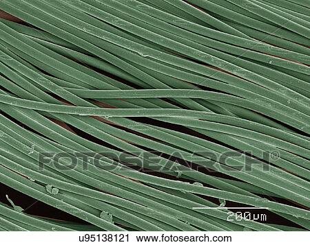 Coloured SEM of dental floss View Large Photo Image Stock Image - Coloured SEM of dental floss. Fotosearch