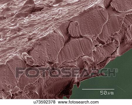 Coloured SEM of dental floss View Large Photo Image Stock Photo - Coloured SEM of dental floss. Fotosearch