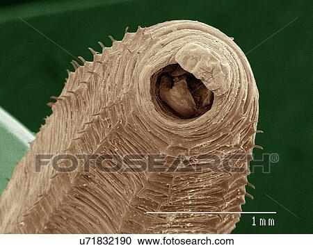 Stock Image - Coloured SEM of earthworm. Fotosearch