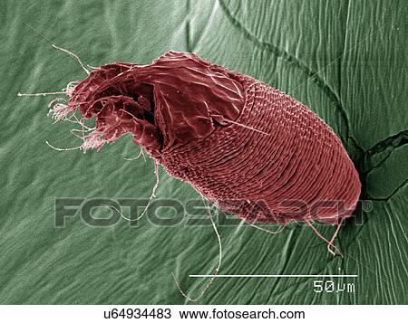 Coloured SEM of eriophyid View Large Photo Image Stock Image - Coloured SEM of eriophyid. Fotosearch
