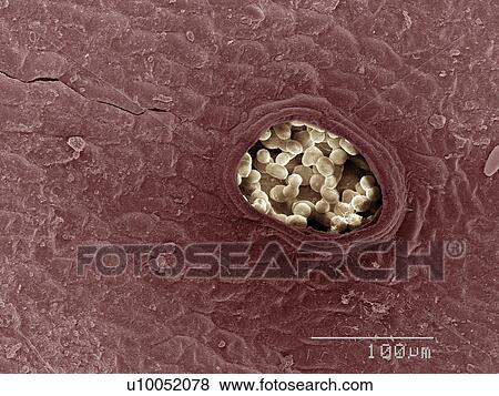 Stock Photo - Coloured SEM of liverwort leaf. Fotosearch
