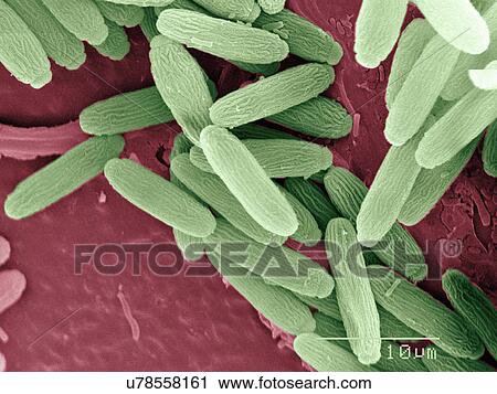 Stock Image - Coloured SEM of mosquito eggs. Fotosearch