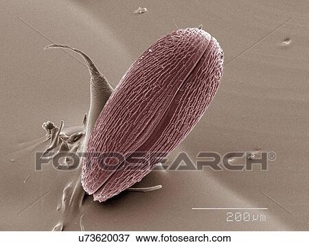 Stock Photo - Coloured SEM of ostracod. Fotosearch