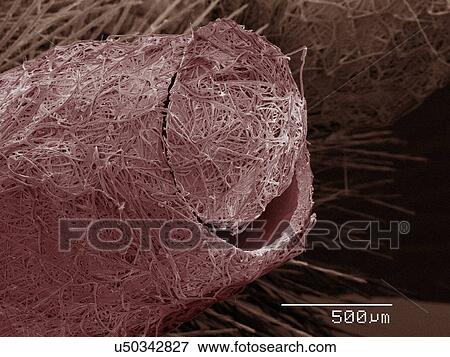 Stock Photo - Coloured SEM of parasitic wasp cocoon. Fotosearch