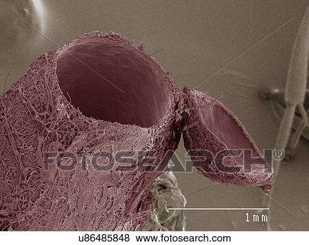 Stock Photo - Coloured SEM of parasitic wasp. Fotosearch