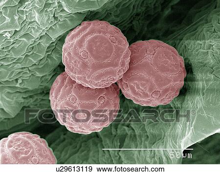 Coloured SEM of pollen of miniature holly View Large Photo Image Stock Photo - Coloured SEM of pollen of miniature holly. Fotosearch
