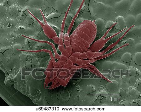 Coloured SEM of pseudoscorpion View Large Photo Image Stock Image - Coloured SEM of pseudoscorpion. Fotosearch