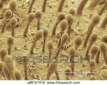 Stock Photograph - Coloured SEM of sundew (Drosera) plant. Fotosearch