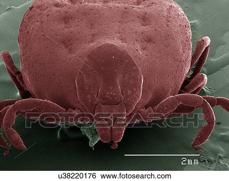 Stock Photograph - Coloured SEM of tick, front view. Fotosearch