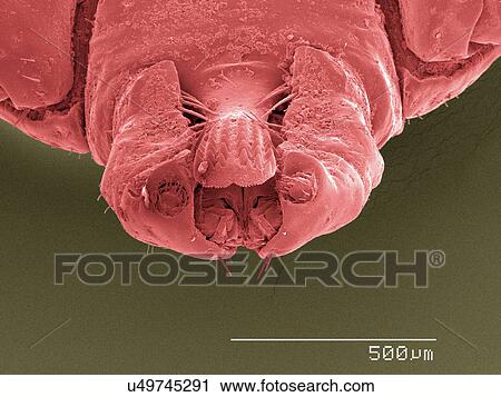 Stock Image - Coloured SEM of tick's mouthparts. Fotosearch