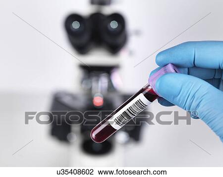 Stock Image - Laboratory scientist holding a blood sample with a upright compound microscope in the background. Fotosearch