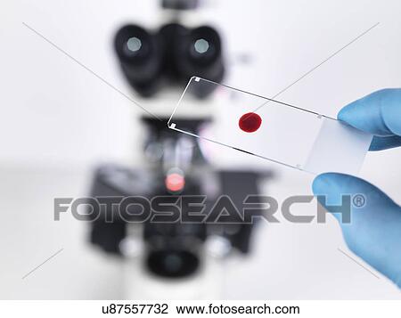 Stock Image - Laboratory scientist holding a slide containing a blood sample with a upright compound microscope in the background. Fotosearch