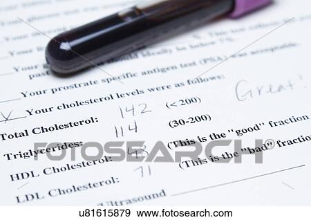 Test tube filled with blood and cholesterol test form document View Large Photo Image Stock Photo - Test tube filled with blood and cholesterol test form document. Fotosearch