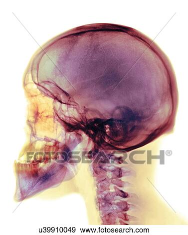 Skull, X-ray View Large Photo Image Stock Photo - Skull, X-ray. Fotosearch