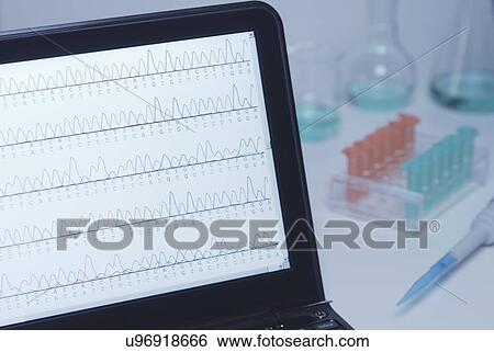 Stock Photograph - A laptop computer displays results of automated DNA sequencing on its screen. Fotosearch