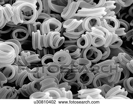 Stock Image - Microscopic fungus on surface of caterpillar, gold coated and imaged in SEM. Fotosearch