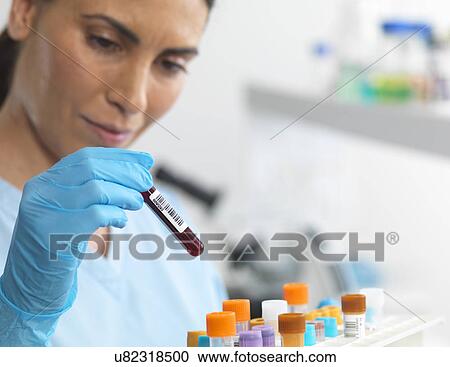 Stock Image - Scientist viewing various human samples for testing in the laboratory. Fotosearch