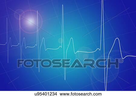 Heart rate graph View Large Photo Image Picture - Heart rate graph. Fotosearch