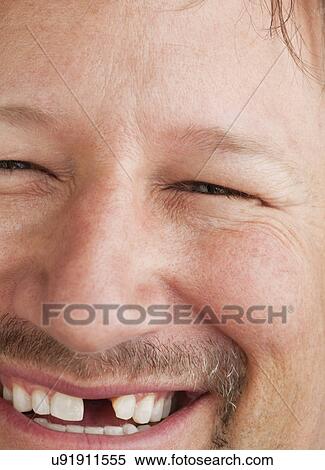 Stock Photography - Portrait of man with missing front tooth. Fotosearch