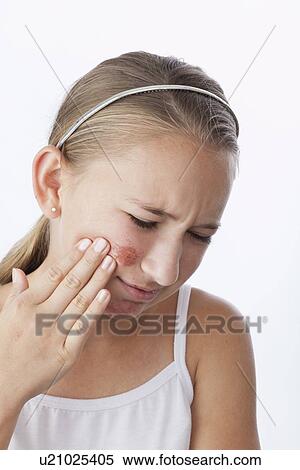 Stock Photography - Studio shot of girl (12-13) with scratches and scars on face. Fotosearch